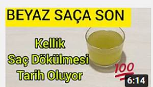 KENDİNİZ YAPABİLECEĞİNİZ BU FORMÜLLE KAFANIZDA BEYAZ SAÇ KALMASIN